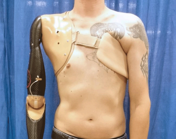 brazos-protesicos-cuerpo