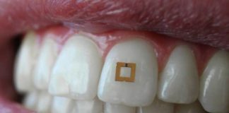 sensor sustancias dientes